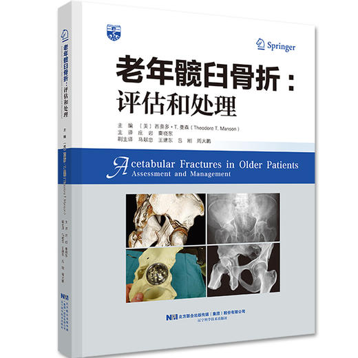 老年髋臼骨折：评估和处理   主译：庄岩 秦晓东   辽科出版 商品图0