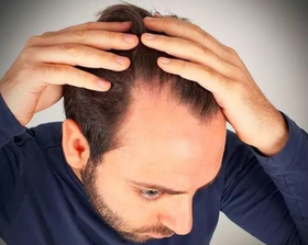 谨慎熬夜 | 当代“秃毛人士”已然成了社会主流群体