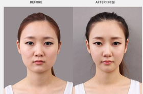 减肥20斤，妈妈竟说我不是她女儿？