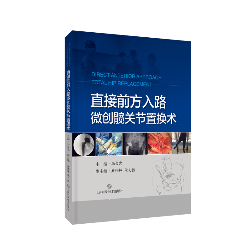 直接前方入路微创髋关节置换术 主编：马金忠   上科出版