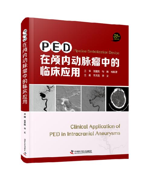 PED在颅内动脉瘤中的临床应用 商品图0