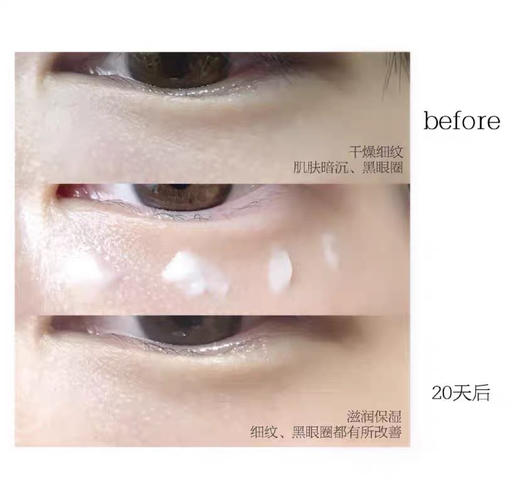 法国兰蔻小黑瓶眼霜20ml 商品图2