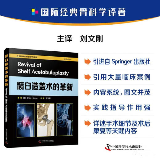 髋臼造盖术的革新   主译：刘文刚    辽科出版 商品图0