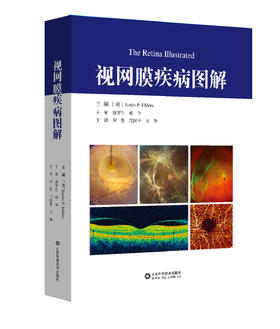 视网膜疾病图解