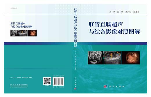 肛管直肠超声与综合影像对照图解/殷骅,蒋天安,郑建军 商品图3