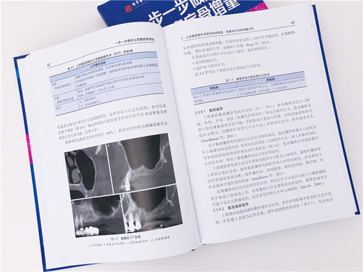 医学精萃系列 一步一步做好上颌窦底骨增量 商品图4