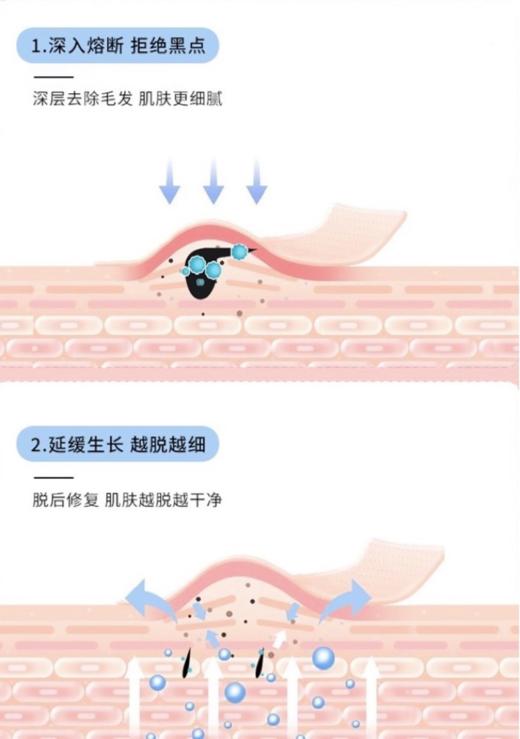 花花品质生活｜日本乐天销量TOP COS ME大赏获奖产品—CM脱M膏  毛根融化技术  美容苑脱M 海绵头专li 方便快速 植物温和配方 男女不限 一支在手 告别毛手毛脚 不做猕猴桃 商品图5