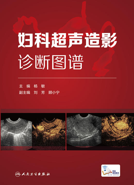 妇科超声造影诊断图谱 总结妇科超声造影及子宫输卵管超声造影的方法技巧等 妇产科书 杨敏 主编9787117315708人民卫生出版社 商品图2