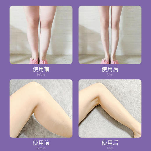 【第2盒半价】SIVE懒人纤腿帖"融脂针"同款成分清爽水凝胶纤薄透气 4片/盒 商品图4