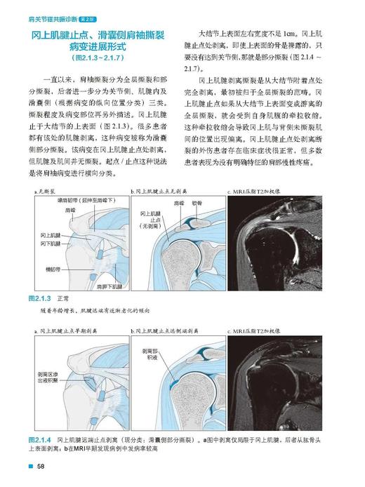 肩关节磁共振诊断 商品图2