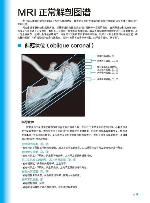 肩关节磁共振诊断 商品图1