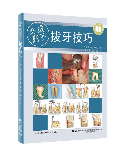 《拔牙技巧》 商品图0