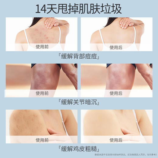 【夏天的浴室必须有它】牛奶烟酰胺搓泥宝专利除螨啫喱清洁去角质死皮不沾体毛男女全身通用 商品图2