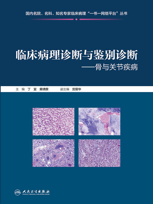 临床病理诊断与鉴别诊断 骨与关节疾病 骨原发性淋巴造血系统肿瘤 软骨性肿瘤 丁宜 黄啸原 主编9787117310406人民卫生出版社 商品图2