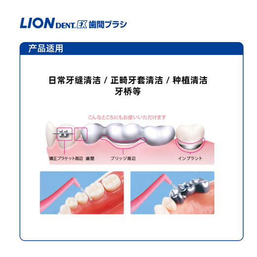 【品牌直发】包邮！日本进口狮王Lion齿间牙缝刷-正畸清洁适用种植牙适用4支装 商品图2