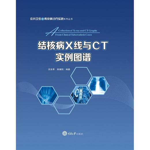 结核病X线与CT实例图谱 商品图0