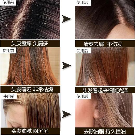 【香港直邮】新旧版本随机【去屑版】THE BODY SHOP/美体小铺 去屑 ANTI-DANDRUFF 生姜洗发水 400ML 商品图3