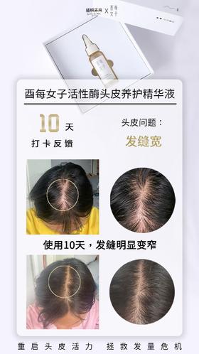 厉害了！10天长出小绒毛！