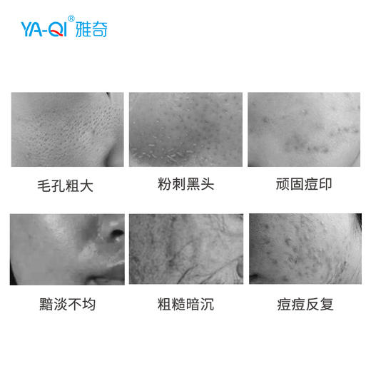 雅奇果酸焕肤精华液 商品图2