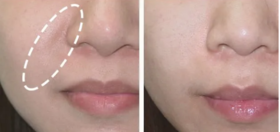 嘴角法令纹一抹淡化！！这款国货太牛了，每天抹一抹，40岁肌肤也能嫩如初恋！！！