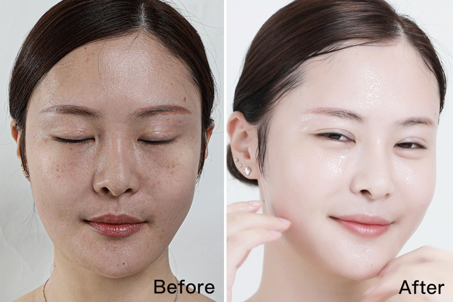 想要美白，一定要记住这个宝藏成分！