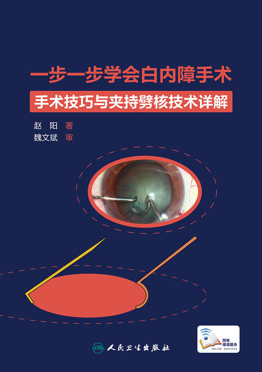 一步一步学会白内障手术 手术技巧与夹持劈核技术详解 眼科学 白内障手术技巧全方位讲解剖析 赵阳9787117313568人民卫生出版 商品图3