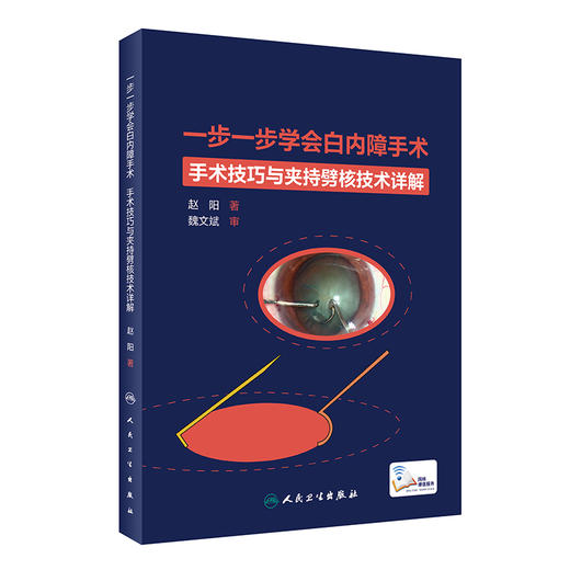 一步一步学会白内障手术 手术技巧与夹持劈核技术详解 眼科学 白内障手术技巧全方位讲解剖析 赵阳9787117313568人民卫生出版 商品图0