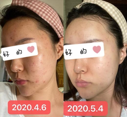 无限回购！修丽可色修精华15ml/30ml 商品图4