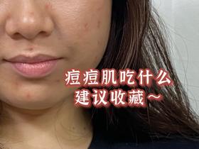 满脸痘啥都不敢吃💥痘肌戳，食物选择指南