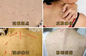  洗澡搓泥，越多越干净？小心搓出一身病！三伏天洗澡讲究多~ 