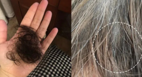  白头发越长越多，原来是这里出了毛病，坚持一招，慢慢远离白发脱发！ 