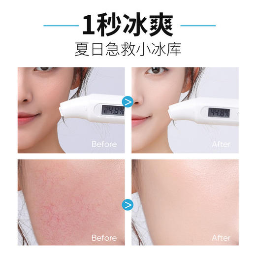 【美妆个护】泉兮晒后修护舒缓冰膜 补水保湿烟酰胺清洁收缩毛孔控油亮肤面膜 商品图2