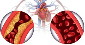  三高都怕它，越吃血管越干净！坚持一个月，头晕眼花不再来！ 