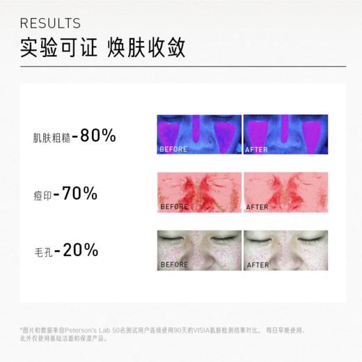 指橙果酸精华水 100ml 商品图2