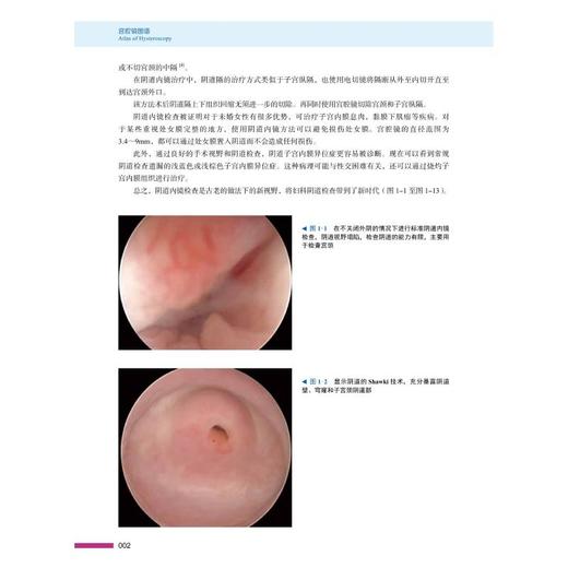 宫腔镜图谱 商品图2