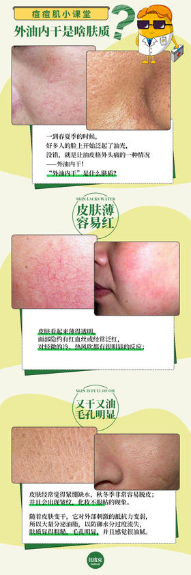 “外油内干”是什么肤质？🤔和干皮肤质有何不同？