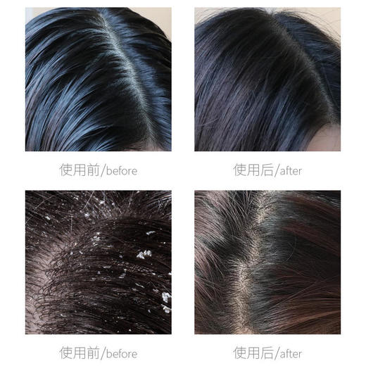 【2瓶立减20】青彩山茶氨基酸精油洗发水  天然植物成分呵护头皮滋养秀发  改善头屑油腻  拯救发际线   300ml/瓶 商品图5