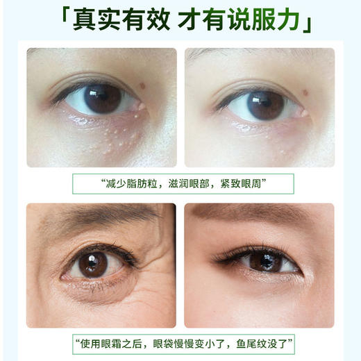 【眼 霜】德德维芙熬夜修护眼霜去脂肪粒淡化黑眼圈细纹提拉紧致 熬夜眼霜 美妆个护 商品图1