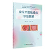 常见口腔黏膜病诊治图解 华红 周刚 口腔科学书籍 局部湿敷激光治疗 免疫调节药含漱剂涂剂用药 人民卫生出版社9787117317337 商品缩略图0