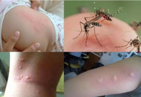  驱蚊界的“香奈儿”！喷它，4米之内24h默默无“蚊”，1瓶搞定整个夏天！ 