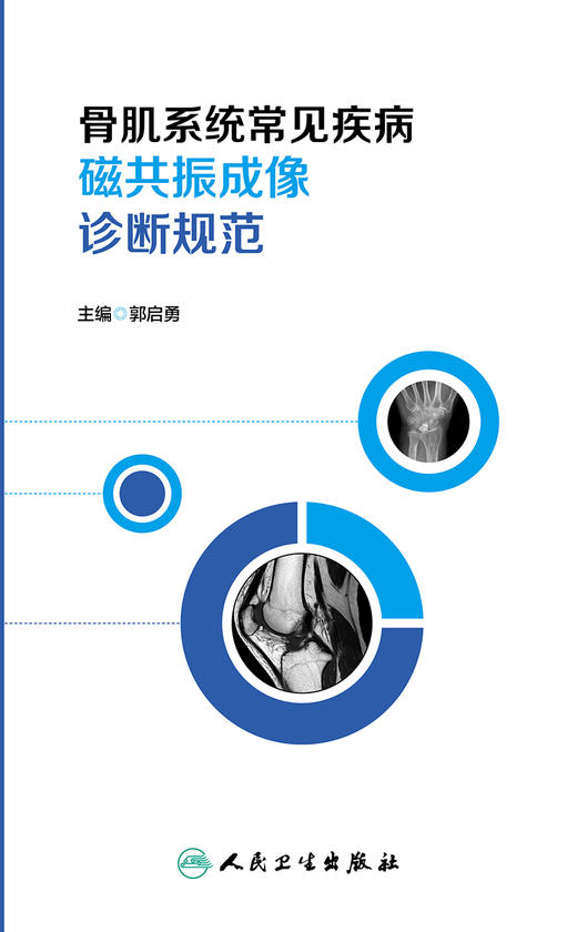 骨肌系统常见疾病磁共振成像诊断规范 商品图1