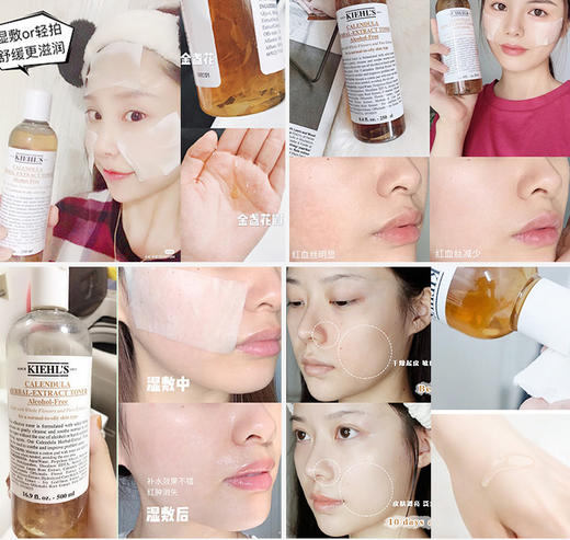 科颜氏金盏花植萃爽肤水 精华水收缩毛孔湿敷水祛痘  250ml 商品图3