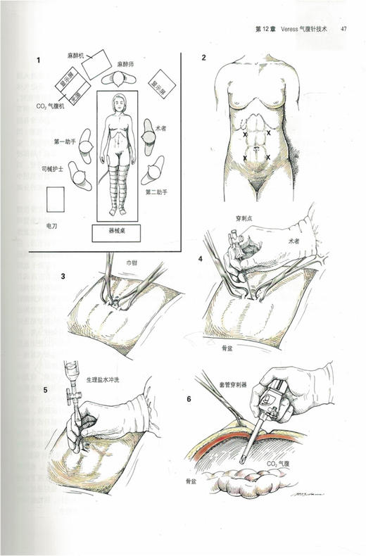 佐林格外科手术图谱 第10版 王杉 叶颖江 译 外科学书籍外科手术操作指南 术前准备麻醉术后管理 北京大学医学出版社9787565915871 商品图4