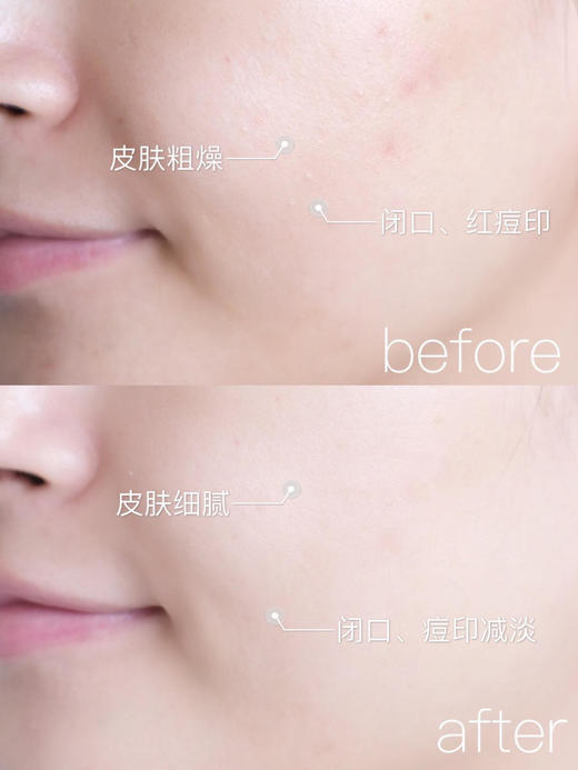 HR赫莲娜绿宝瓶悦活新生肌源精华100ml 商品图3