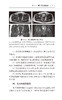 骨肌系统常见疾病磁共振成像诊断规范 郭启勇 主编 影像放射医学 骨科学书籍骨科疾病影像诊断 人民卫生出版社9787117315654 商品缩略图3