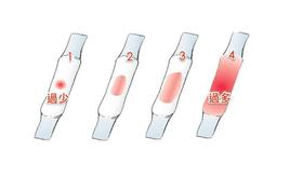 月经量少是因为卵巢早衰了吗？