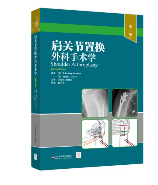 肩关节置换外科手术学（第2版） 商品图0