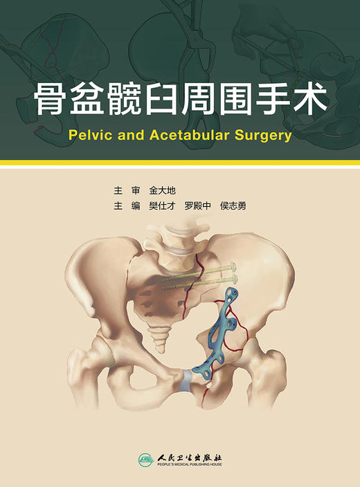 骨盆髋臼周围手术 商品图1