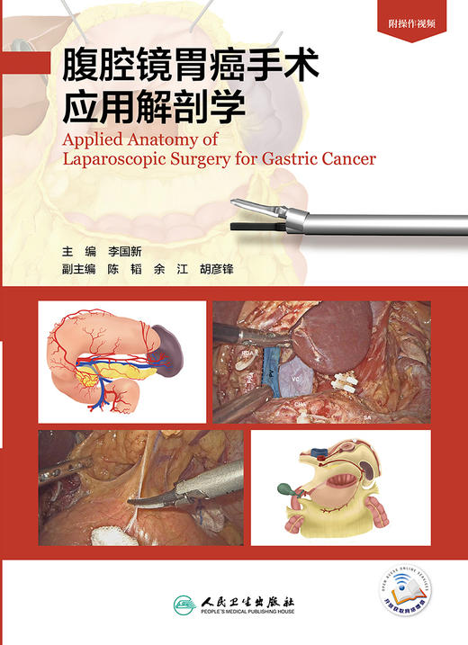 腹腔镜胃癌手术应用解剖学 商品图1