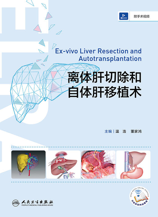 离体肝切除和自体肝移植术 商品图1
